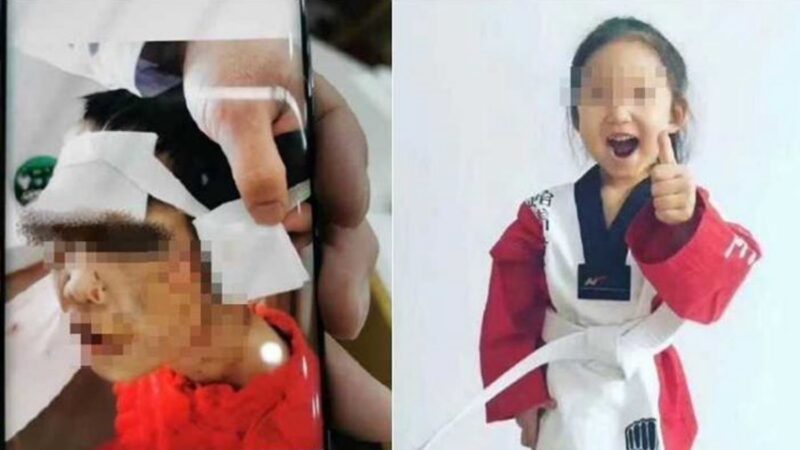 黑龙江4岁女童被继母虐打曝光。