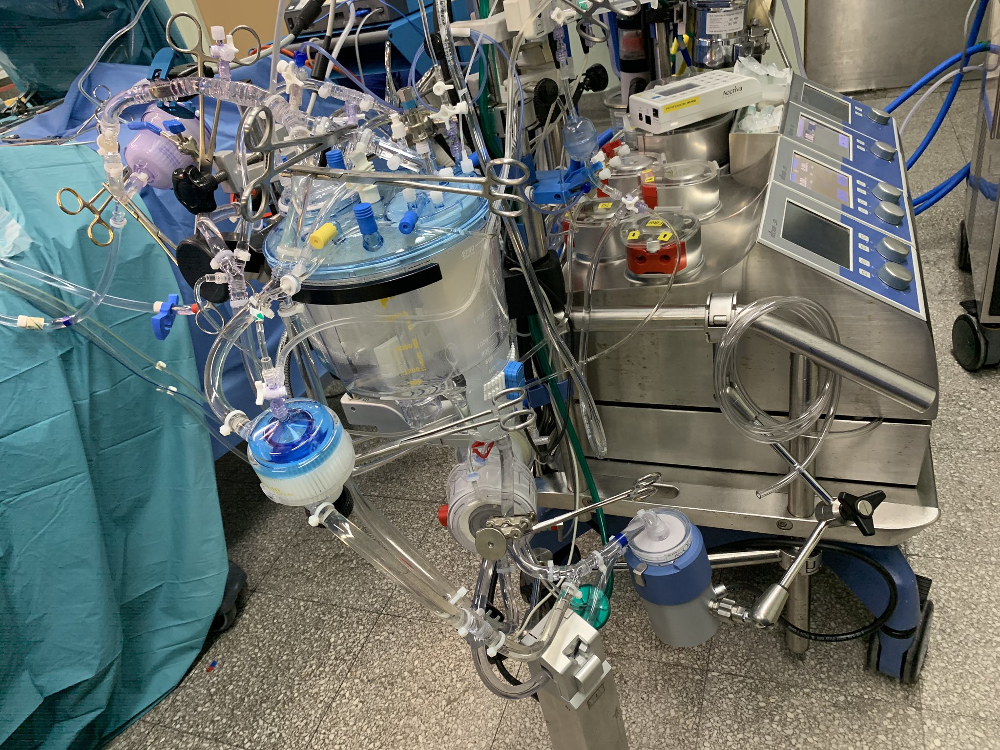 ECMO