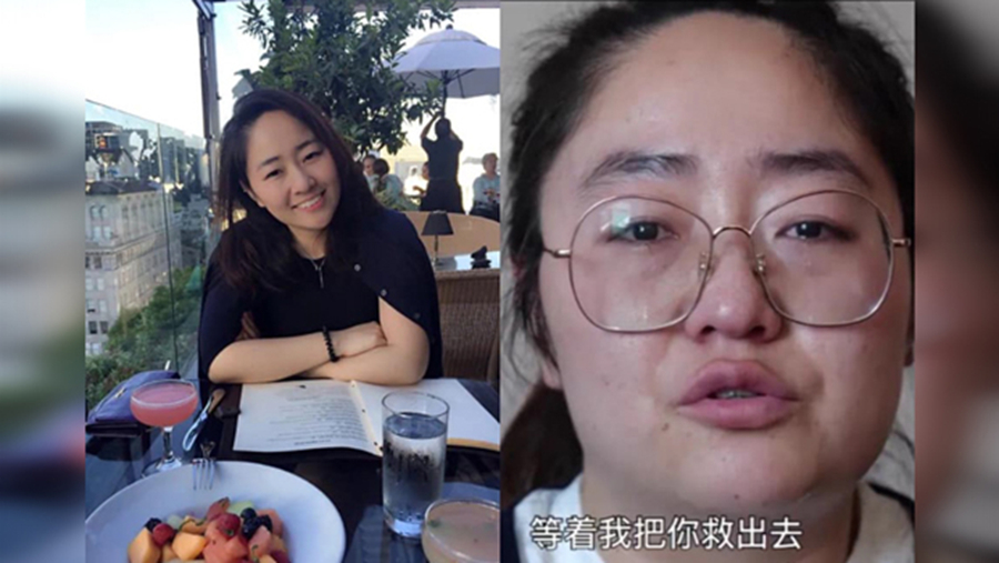 回國後經歷各種壓力之後的王然已十分憔悴。（自由亞洲電台）