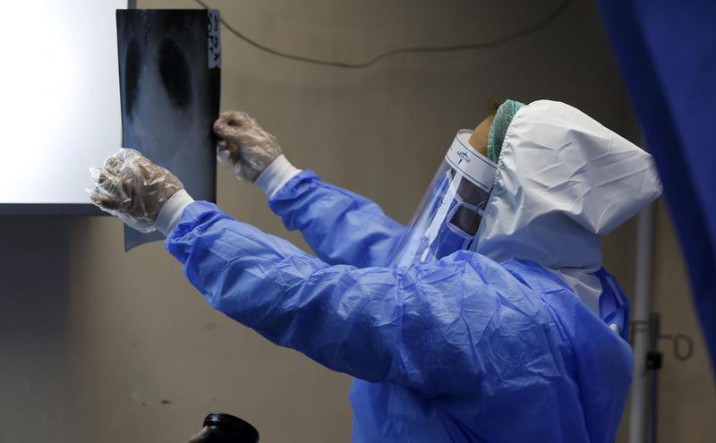 大马士革大学医院人员正在检查胸部X光片。