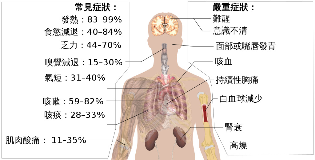 武汉,病毒,症状