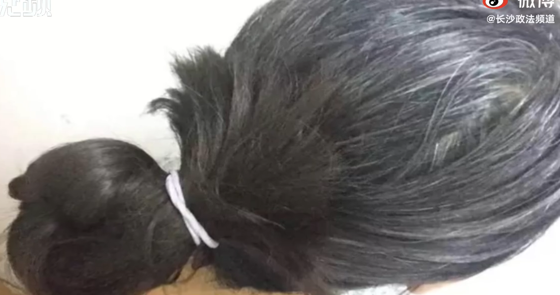 女子因生出白发进食何首乌结果导致肾衰竭