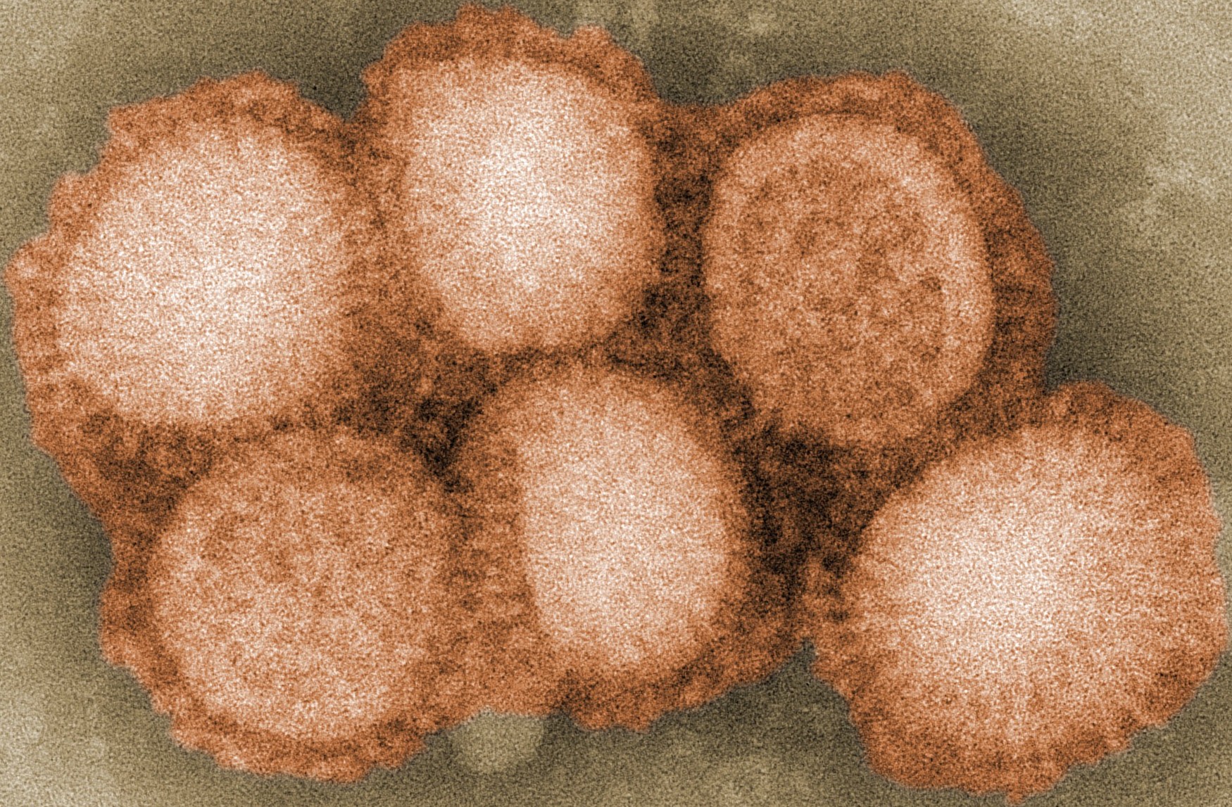 H1N2病毒