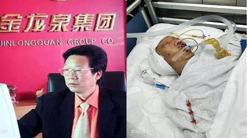 “荆门首富”在“最牛医院”术后脑死 最后一句话“我又被骗了！”