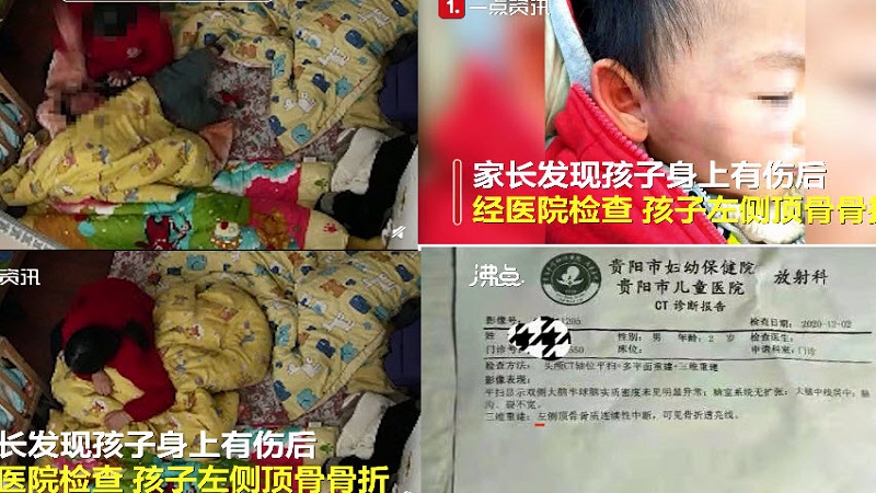 老师狂扇2岁幼儿 导致男童头部骨折