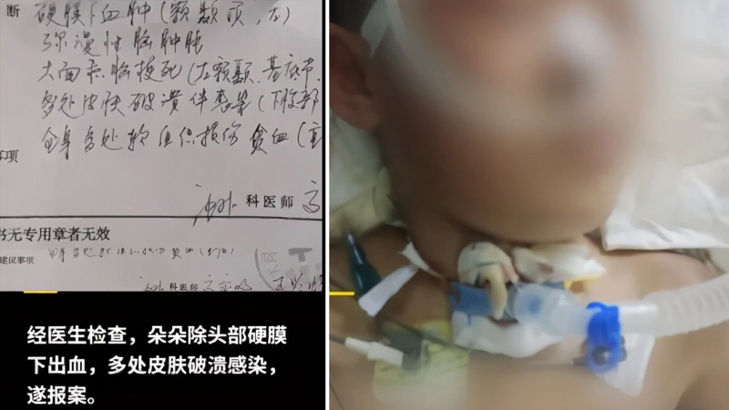 山西懷仁12歲女孩遭繼母虐待腦死亡