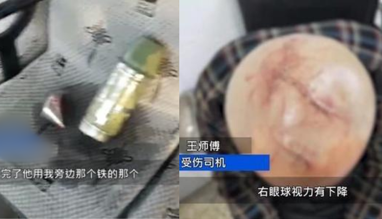 公交司机遭乘客疯狂锤头缝20针