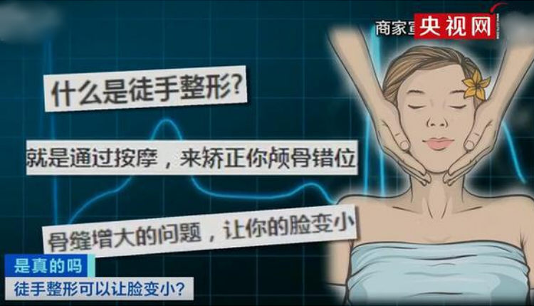 徒手整形