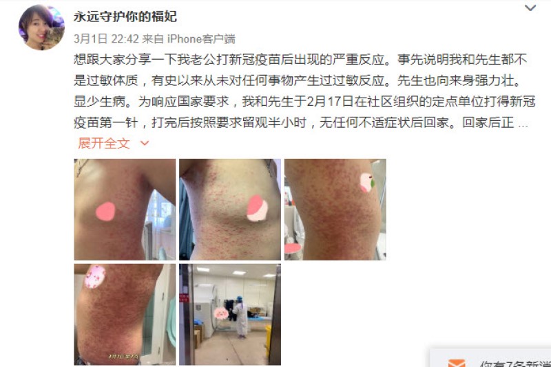 男子身上遍布红疹