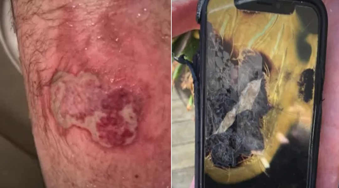 苹果手机爆炸
