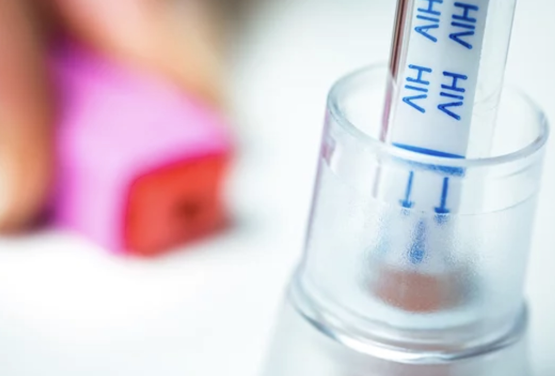 艾滋病毒（HIV）自我检测试剂盒