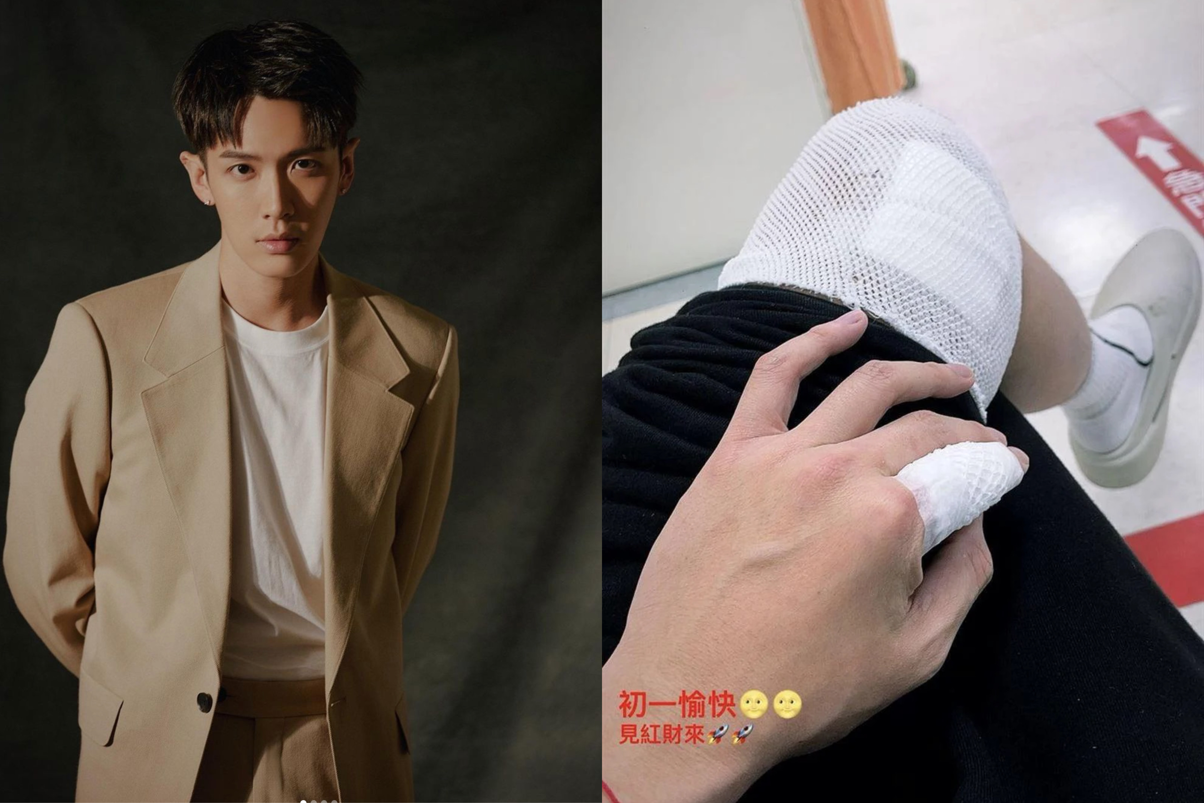 柯震东受伤