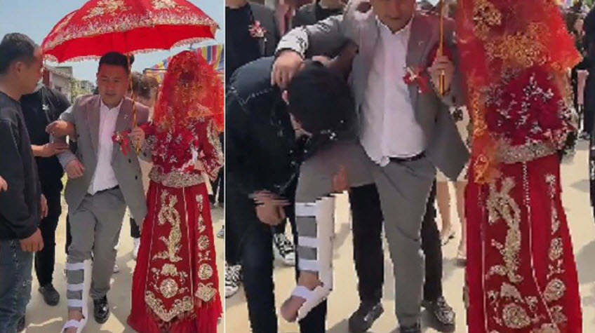 恶俗为何屡禁不止？因婚闹新郎的腿被压断