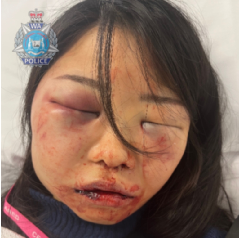来源：西澳警方