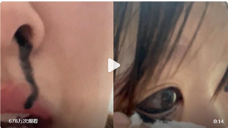 笑歪！中国妙龄女眼线笔漏水 黑色墨水从鼻孔流出