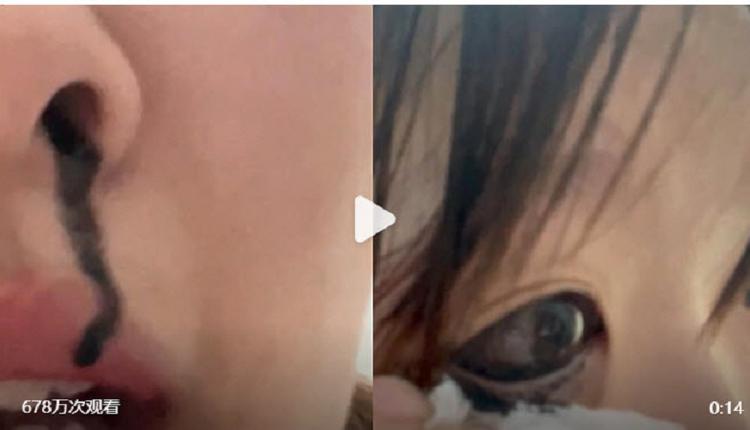笑歪！中国妙龄女眼线笔漏水 黑色墨水从鼻孔流出