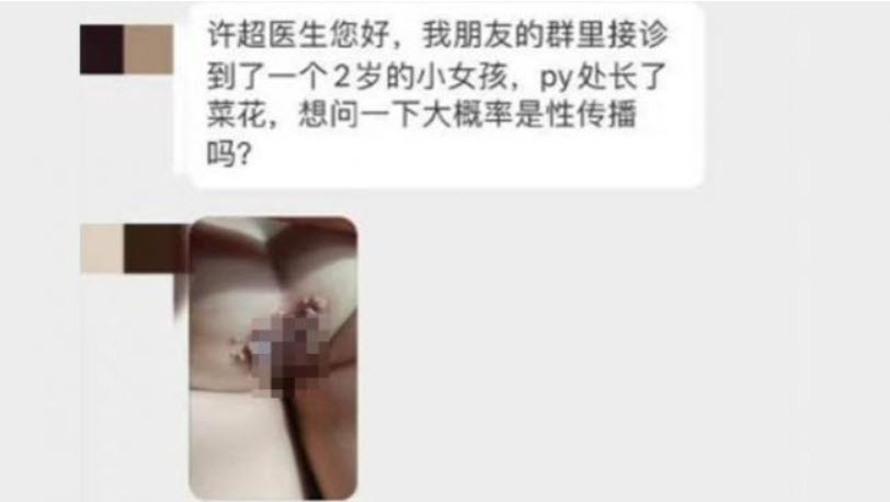 网友质疑2岁女童在父母知情下被亲友性侵 消息被封