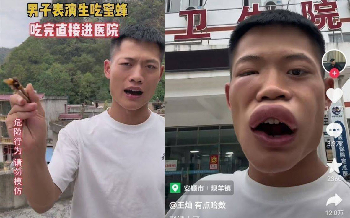 用生命赚流量 男网红拍片生吃蜜蜂 下场超惨