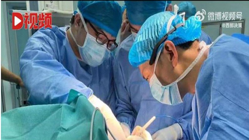 深圳畸形儿“四手四脚”医生：病发率约50万分之一