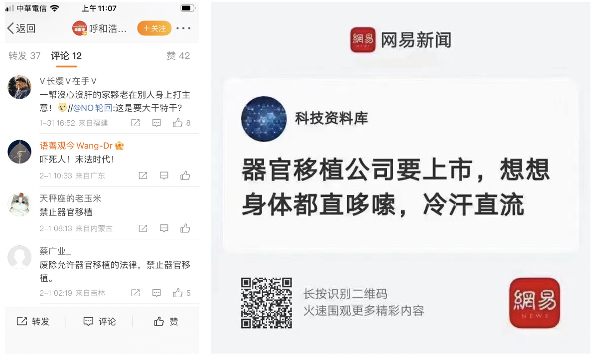 器官移植