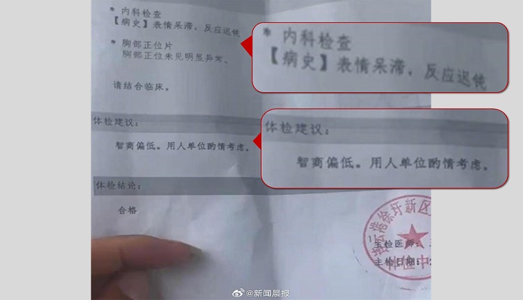 体检报告称受检者智商偏低