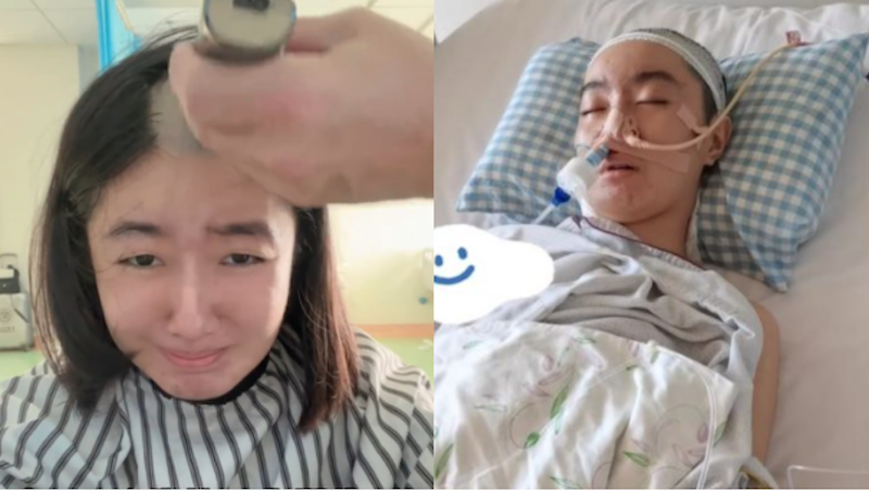中国艺人高君雨患脑瘤被指造假