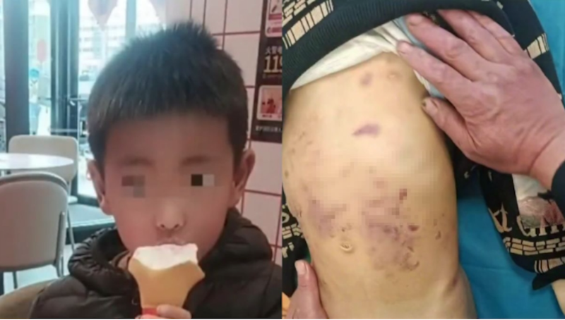 山東5歲男童疑被親母及其男友虐殺