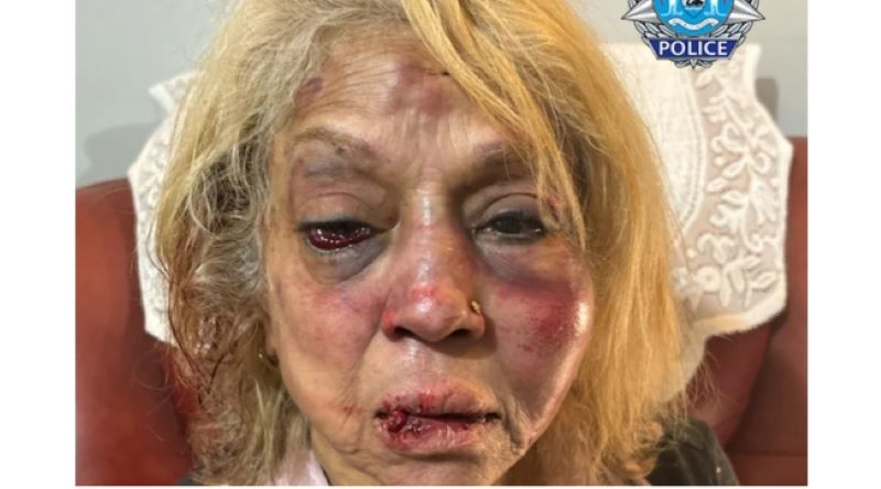 Ninette  Simons 被暴徒打傷