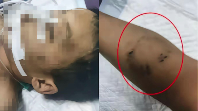 上海3岁半男童疑被生父女友虐待致死